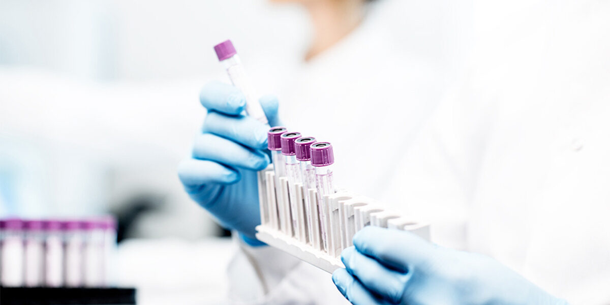 RX Medical Καλαμάτα – In Vitro Διαγνωστικά προϊόντα – Εξέταση COVID-19 RX Medical Καλαμάτα - In Vitro Διαγνωστικά προϊόντα - Εξέταση COVID-19