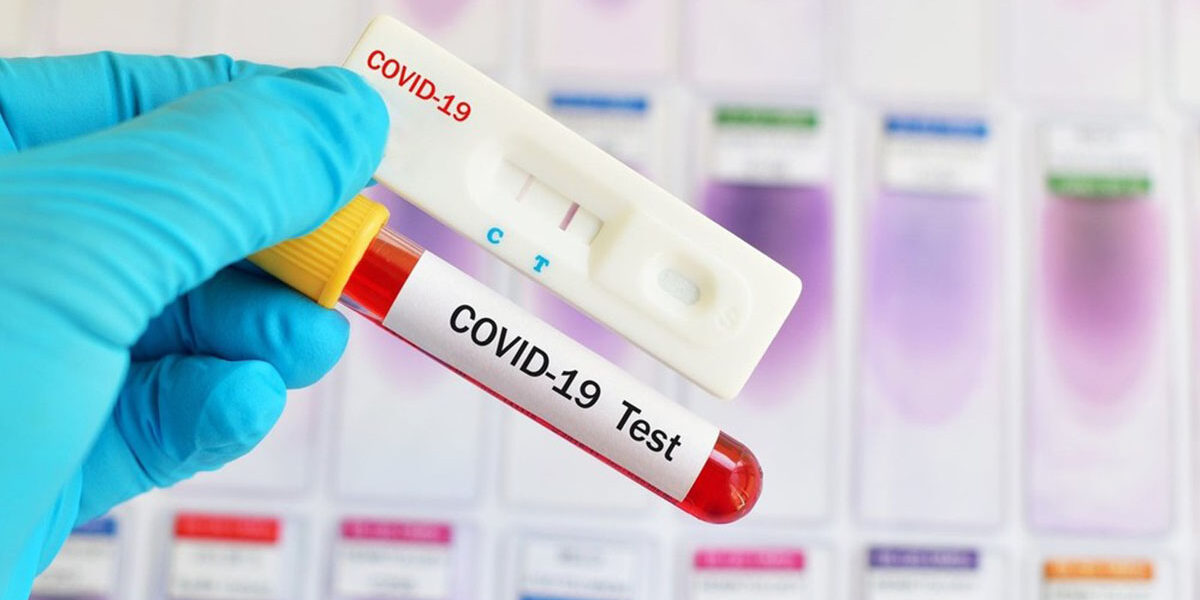 RX Medical Καλαμάτα – In Vitro Διαγνωστικά προϊόντα – Εξέταση COVID-19 – 3 RX Medical Καλαμάτα - In Vitro Διαγνωστικά προϊόντα - Εξέταση COVID-19