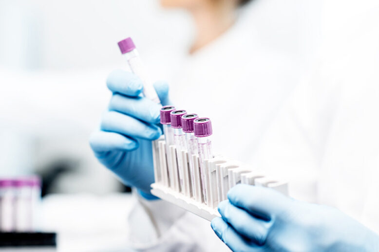 RX Medical Καλαμάτα - In Vitro Διαγνωστικά προϊόντα - Εξέταση COVID-19