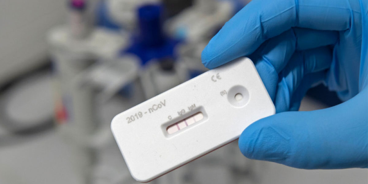 RX Medical Καλαμάτα – In Vitro Διαγνωστικά προϊόντα – Εξέταση COVID-19 – Μέρος 2ο RX Medical Καλαμάτα - In Vitro Διαγνωστικά προϊόντα - Εξέταση COVID-19 - Μέρος 2ο