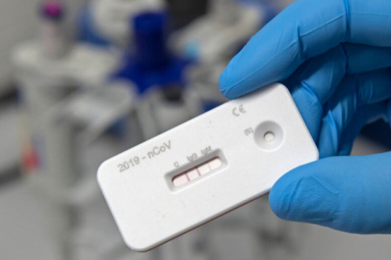 RX Medical Καλαμάτα - In Vitro Διαγνωστικά προϊόντα - Εξέταση COVID-19 - Μέρος 2ο